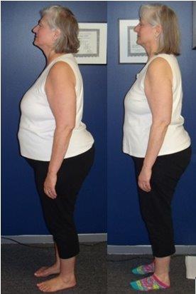 “I have more physical confidence and feel better about myself, and more than two years of ankle pain disappeared!”